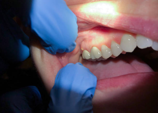 Dentist for Dental Trauma in PA