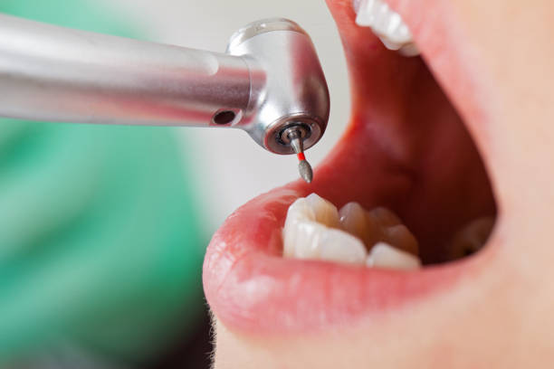 Best Cracked Tooth Emergency Dentist  in Plumsteadville, PA